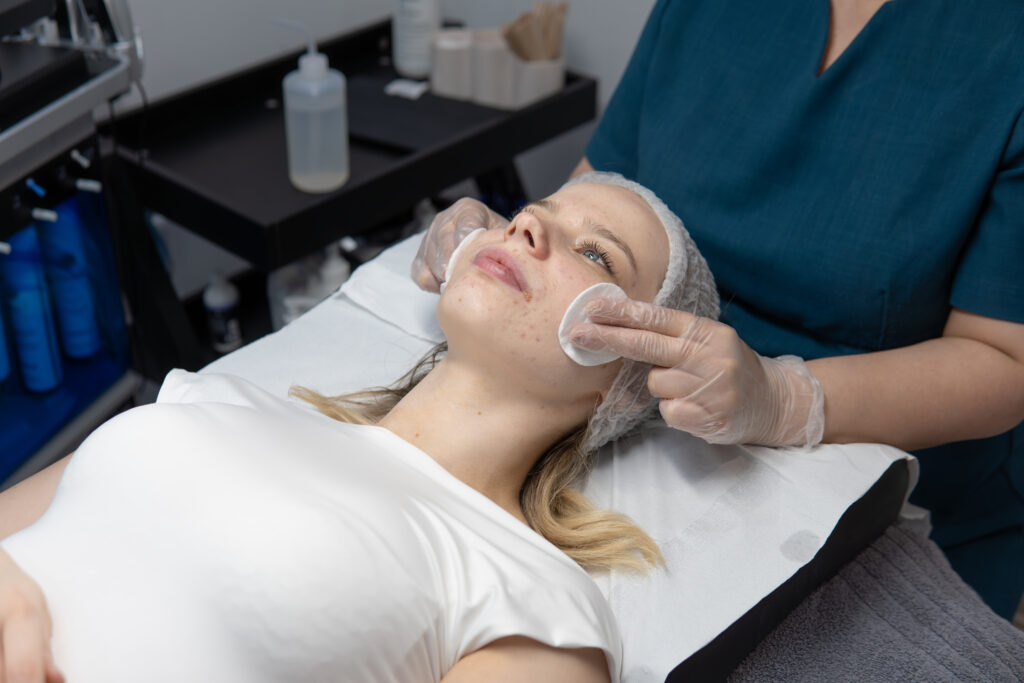 Chemical peel skincare