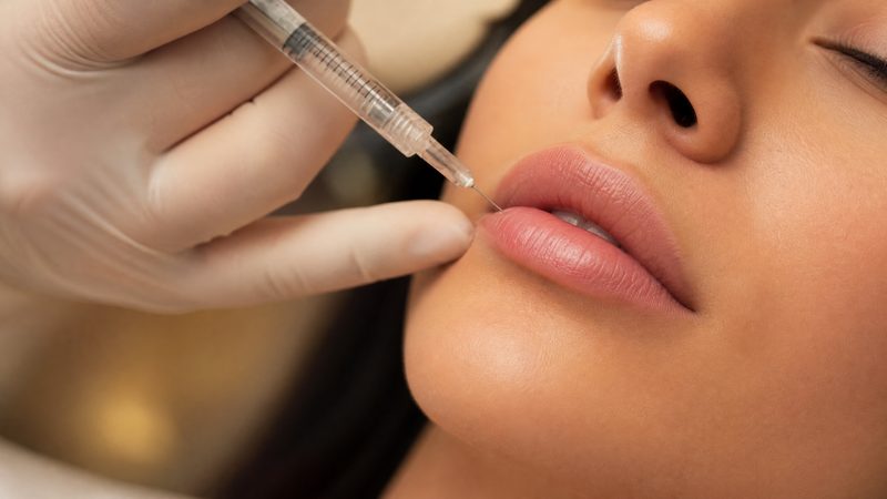 Treatment Lip Filler