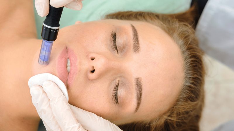 PRP platelet-rich plasma therapy
